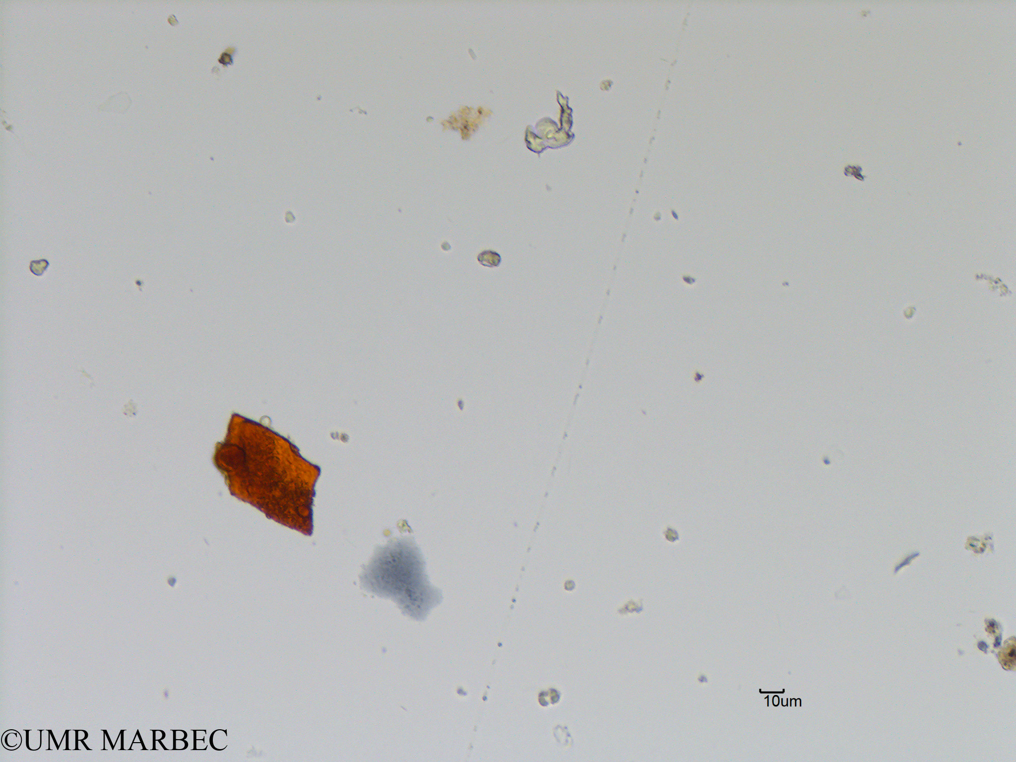 phyto/Bizerte/bizerte_bay/RISCO November 2015/Thalassiothrix mediterranea var. pacifica (Baie_T5-C3-leptocylindrus ou lioloma-11).tif(copy).jpg
